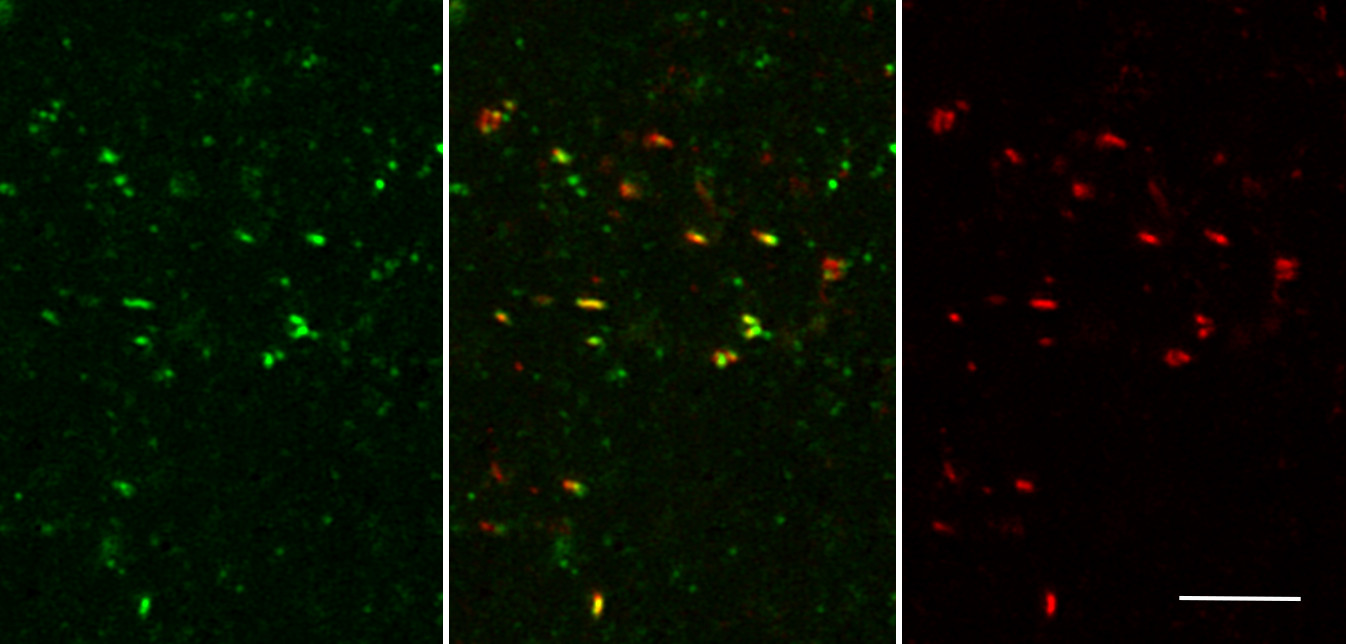 DAP1, Polyclonal Guinea pig antiserum